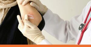 Urgent Care Doctor for Insect Bites - walk in clinic fairfield ct