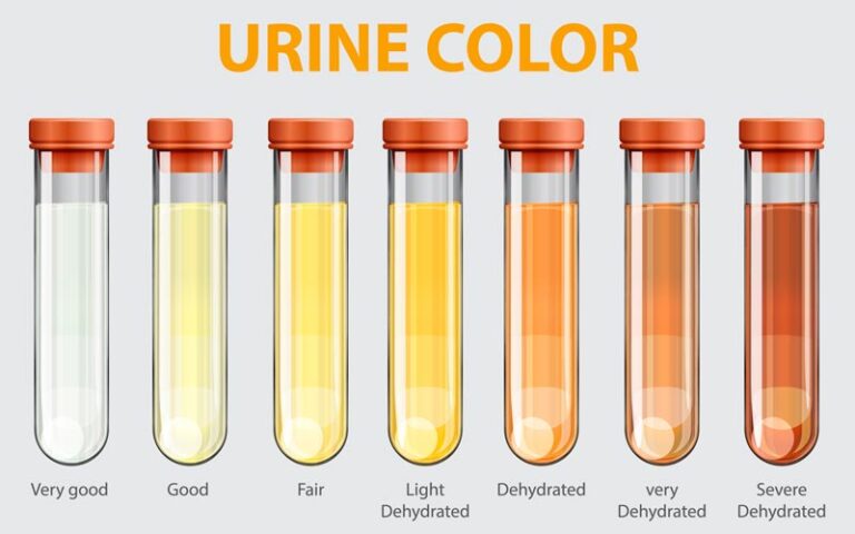 Common Urine Lab Tests at Urgent Care Centers