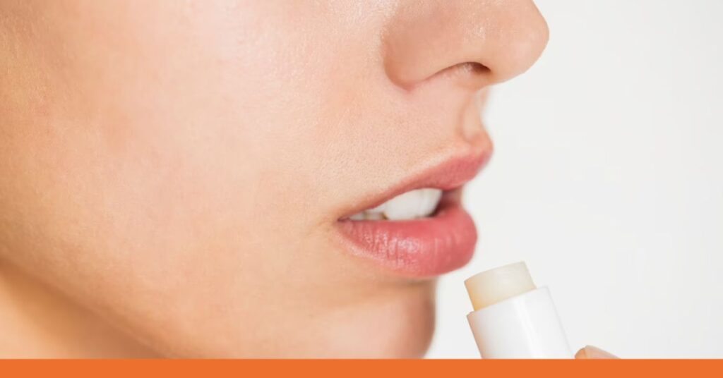 The Ultimate Guide to Cold Sores Causes, Treatment, and Prevention