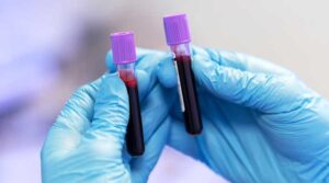 Help Fight STD Prevalence! Undergo STD Testing in Stamford, CT, Today!​