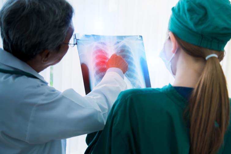 The Severe Symptoms of Bronchitis​