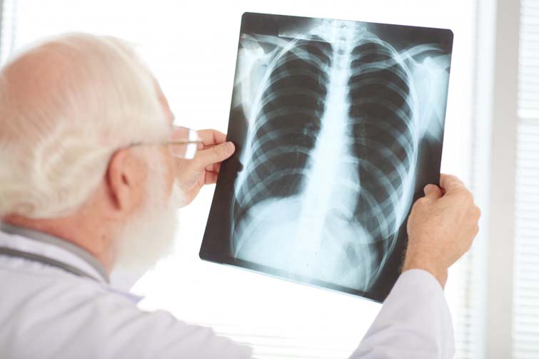 Understanding Bronchitis and When to Seek Urgent Care in Bridgeport, CT
