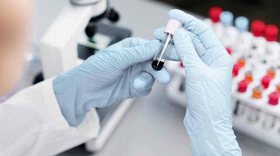 5 Key Reasons Why Asymptomatic Individuals Shouldn’t Skip STD Testing in Southington, CT
