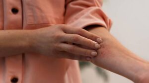 Bad Bug Bites: When to Seek Urgent Care in Bridgeport, CT