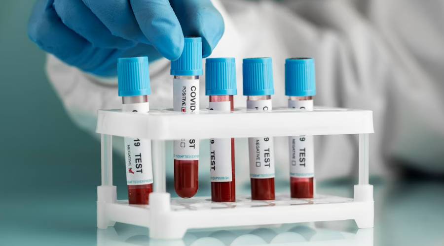 Regular STD testing in Southington, CT