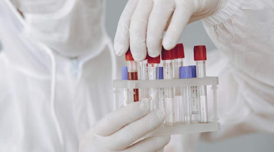 Why You Should Get Tested for HPV