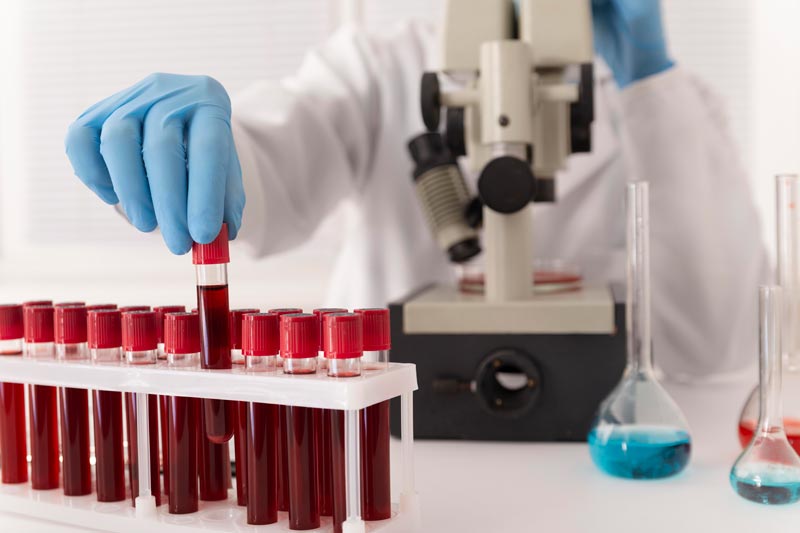 Away From Home? 8 Ways to Access STD Testing in Southington, CT, When Traveling