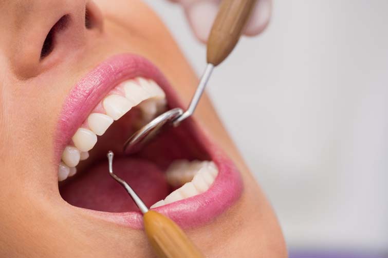 Excessive Gum Bleeding or Swelling