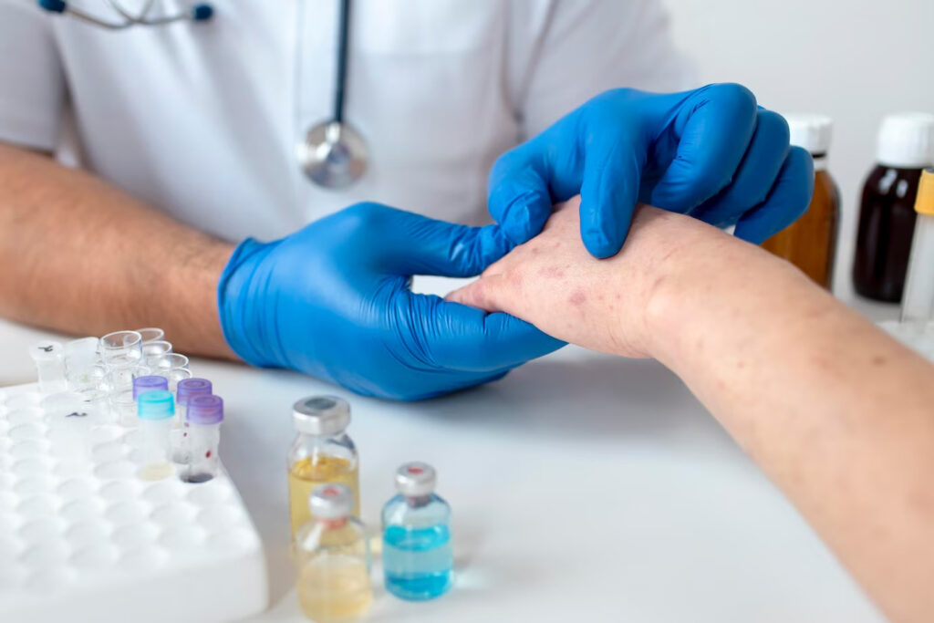 9 Signs to Head to Urgent Care in Southington, CT, for Your Skin Problems