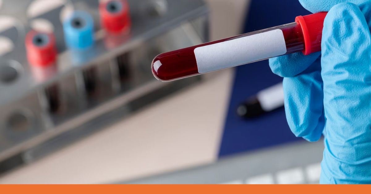 The Importance of STD Tests in Fairfield, CT