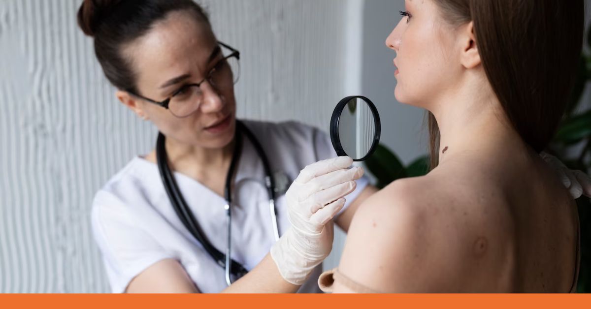 When to Consult Your Primary Care Doctor for Eczema