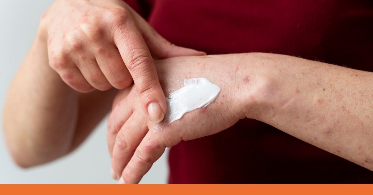 When to Contact an Urgent Care for Skin Irritations