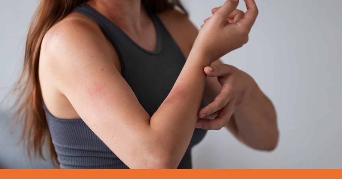 Common Types of Skin Irritations