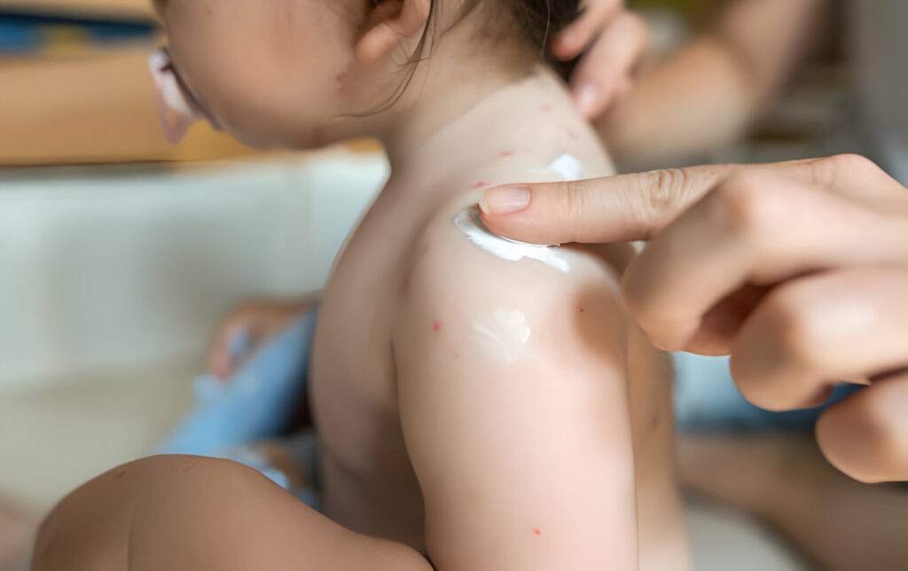 How to Know When Your Baby Needs Urgent Care for Rashes