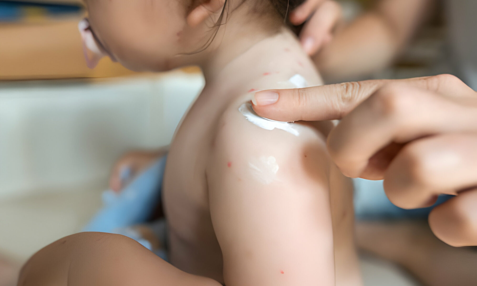 How to Know When Your Baby Needs Urgent Care for Rashes