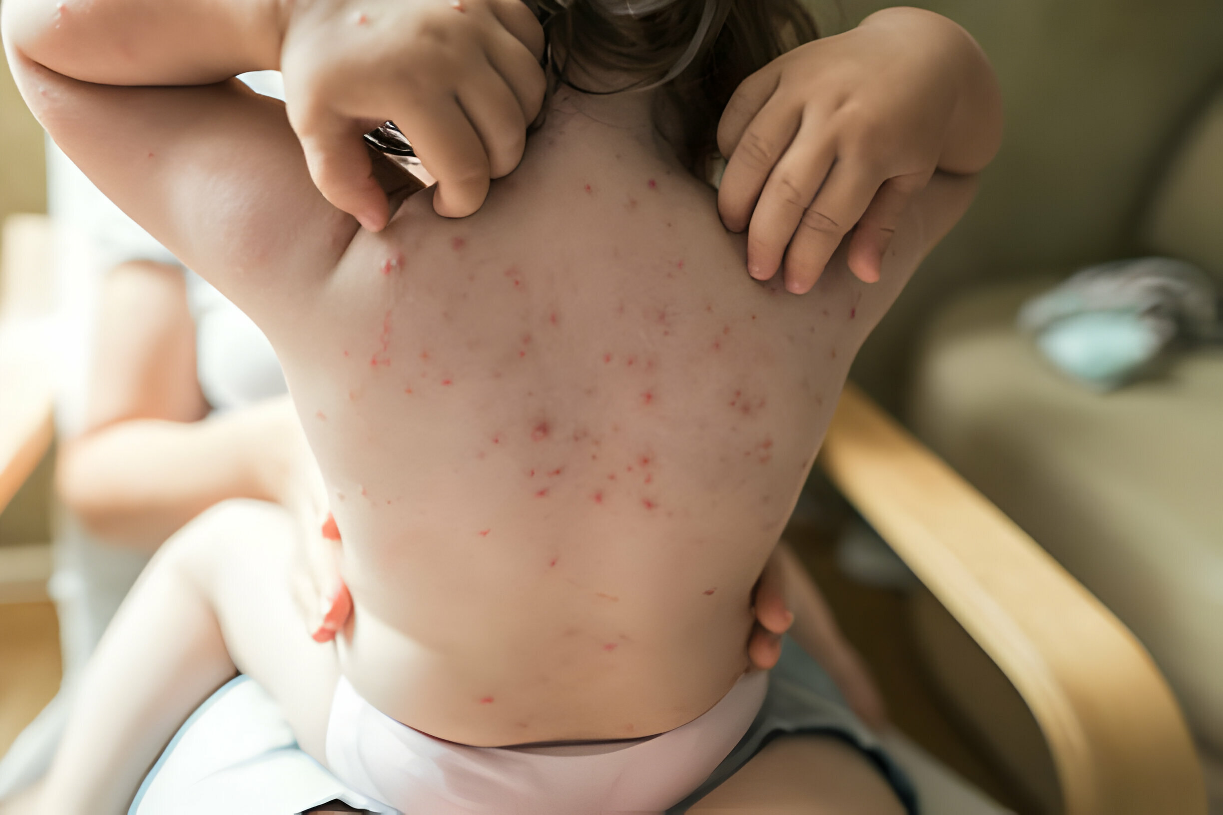Why Urgent Care Matters for Your Baby's Rash
