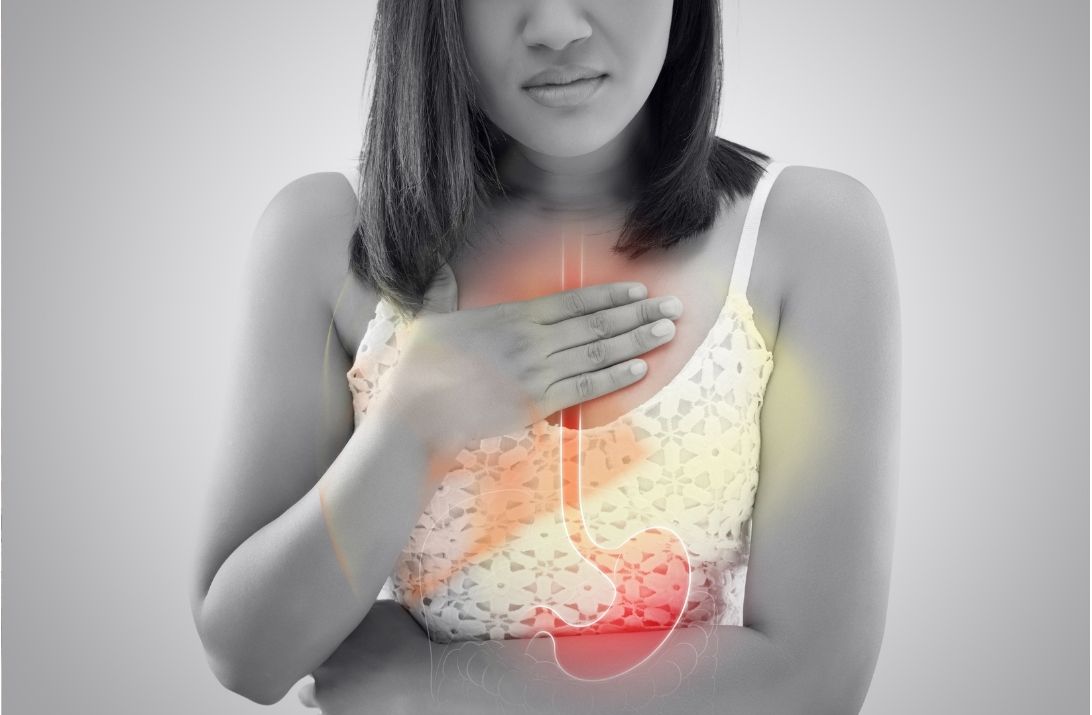 7 Alarming Symptoms of Acid Reflux — When a Consult to Primary Care Doctor in Bridgeport, CT?