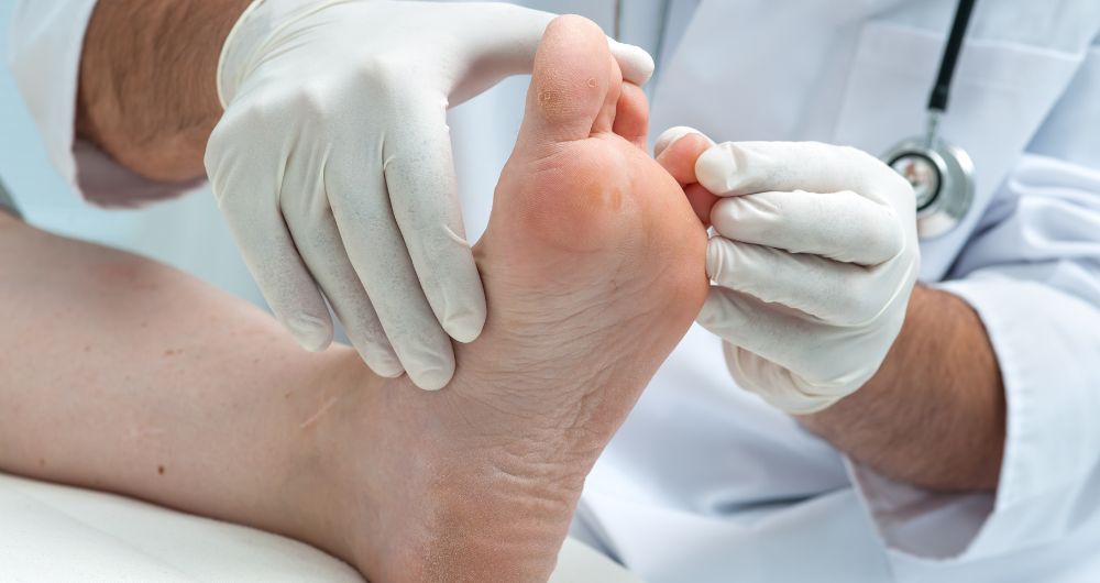 When to Consider Urgent Care for Athlete Foot?