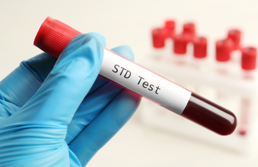 5 Frequently Asked Questions About STD Testing