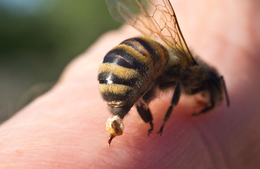 What Is a Bee Sting?​