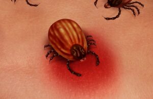 8 Lyme Disease Myths Busted by Doctors in Urgent Care in Southington, CT