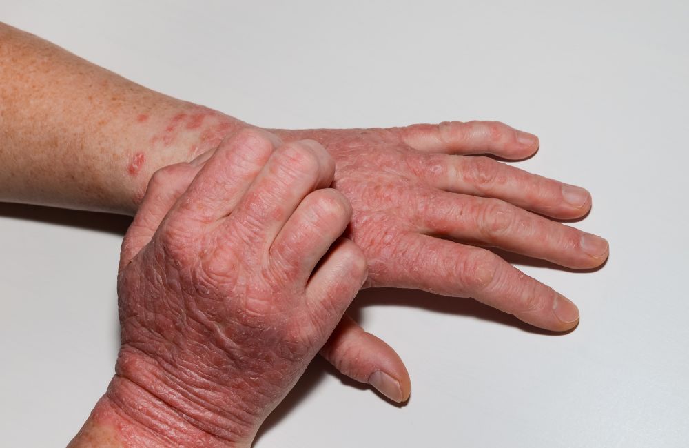 Treatment Options Available Through Your Primary Care Doctor in Southington, CT
