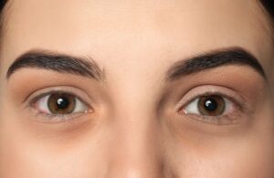 How to Prevent Pallor