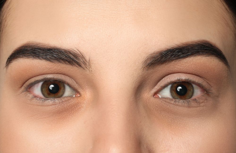How to Prevent Pallor