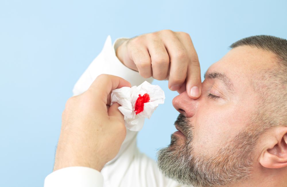 What is Epistaxis?​