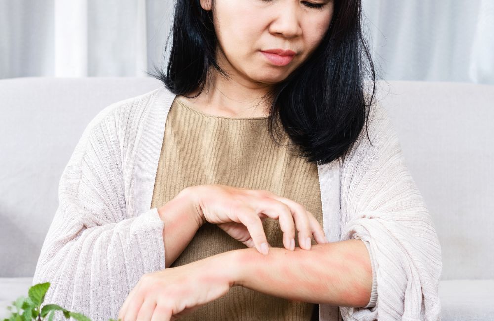 Ways to Treat Hives: Insights from a Primary Care Doctor in Fairfield, CT