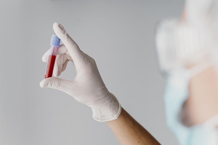 10 Essential Tips for Preparing for a Blood Test at a Trusted Urgent Care in Southington, CT