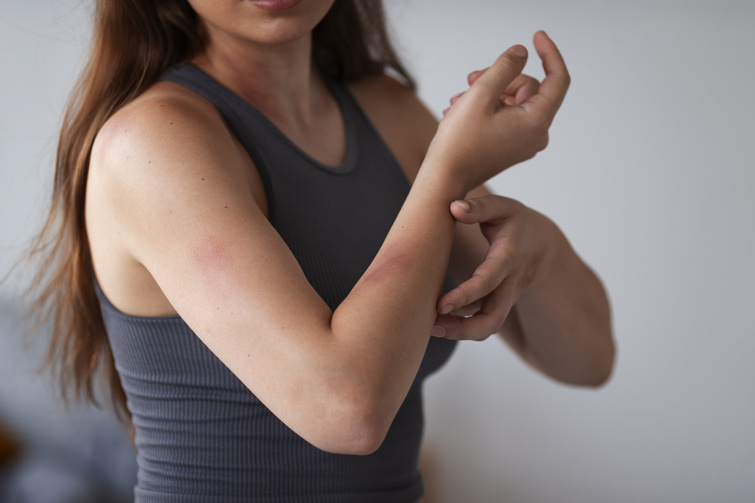 Bruises: Causes, Treatments, and Signs You Need to Visit an Urgent Care in Stamford, CT