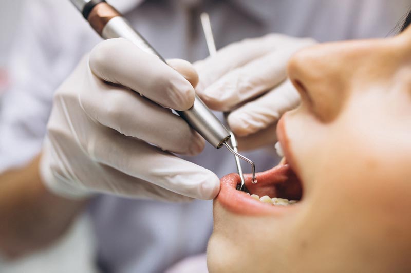 Addressing Dental Abscesses