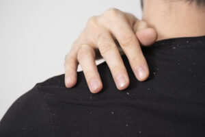 Fungal Nail Infections: Symptoms, Causes, and When to Seek Urgent Care in West Hartford, CT