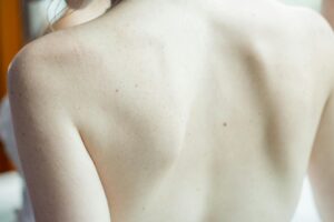 Feel Fresh & Confident Daily! Get Expert Body Odor Solutions at Docs Primary Care - Fairfield!