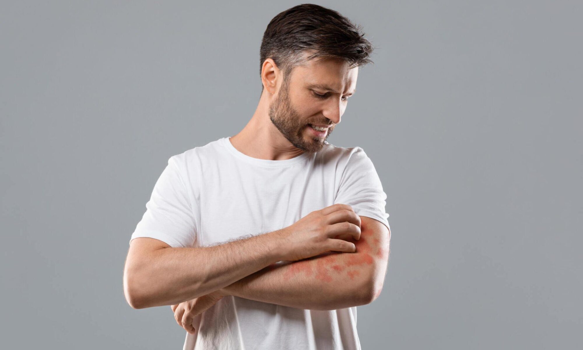 Skin Infections: Symptoms, Causes, and When to Seek Urgent Care in Stamford, CT