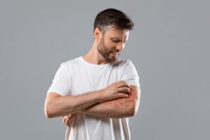 Skin Infections: Symptoms, Causes, and When to Seek Urgent Care in Stamford, CT