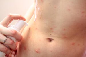 What are the most common types of skin infections treated at urgent care in Stamford, CT?